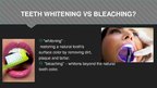 Prezentációk 'Professional Teeth Bleaching', 3.                