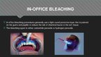 Prezentációk 'Professional Teeth Bleaching', 6.                